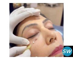 Thread Lift Treatment in Delhi - 1