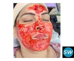 vampire facial treatment in delhi