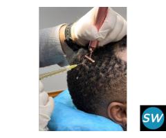 prp treatment for hair restoration in delhi