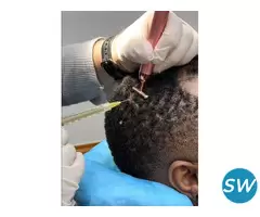 prp treatment for hair restoration in delhi - 1