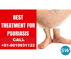 Psoriasis treatment doctor in South Delhi