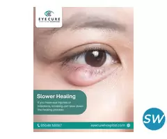 Best eye care hospital in hyderabad - 1