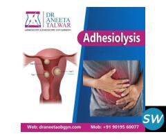 Best Adhesiolysis Surgery in Whitefield, Manipal