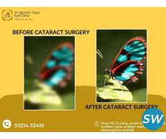 top cataract surgeons near me