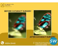 top cataract surgeons near me
