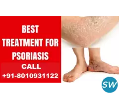Best eczema treatment in Connaught Place - 1