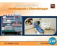 Best Dental Clinic in Chandanagar/ Madinaguda