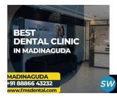 Best Dental Clinic in Chandanagar/ Madinaguda