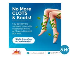 Best Laser Treatment for Varicose Veins