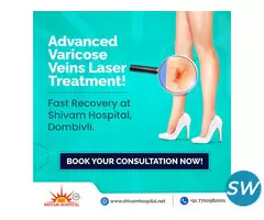 Best Laser Treatment for Varicose Veins