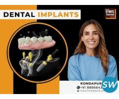 FMS Best Dental Hospital In Kondapur