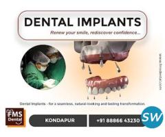 FMS Best Dental Hospital In Kondapur