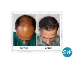 Restore Your Confidence