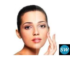 Dermal Fillers Treatment in Hyderabad - 1