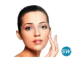 Dermal Fillers Treatment in Hyderabad - 1