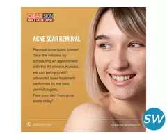 Laser treatment clinic in india - 1