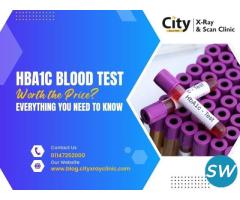 HBA1C Test : Everything You Need to Know