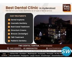 Best Dental Clinic in Hyderabad