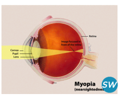 Keratoconus Treatment Effective