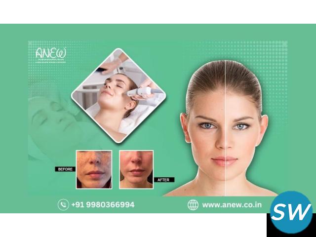 Best Pigmentation Treatment in Bangalore at Anew - 1