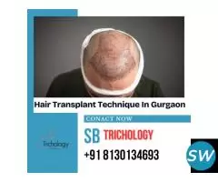 Check Our Hair Transplant Technique In Gurgaon