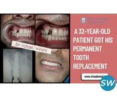 Get a Perfect Smile in Just ONE Hour!