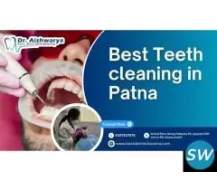 Best Teeth Cleaning in Patna - 2