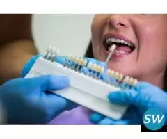 Porcelain Veneers at Best Price – Aashu Dental - 2