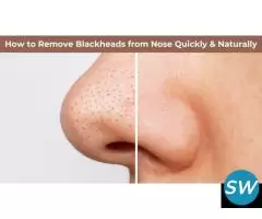 How to Remove Blackheads from Nose