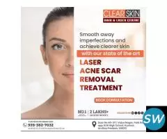 best laser treatment clinic in india - 1