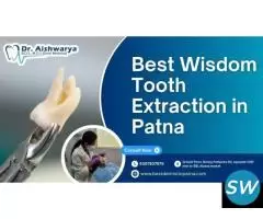 Best Wisdom Tooth Extraction in Patna