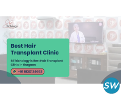 Where To Get Best | Hair Transplant Clinic