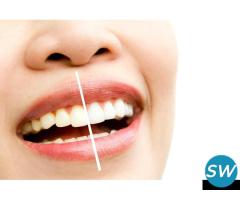 Teeth Whitening at Discounted Rates
