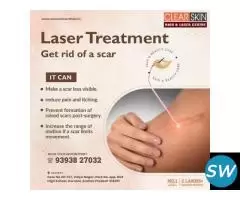 best Birthmark removal laser treatment in india