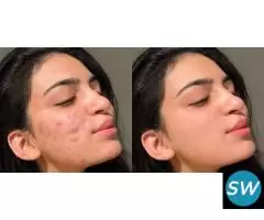 Photo retouching service