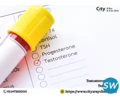 Testosterone Level Test Price Clear Cost