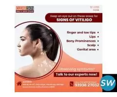 best advanced acne laser treatment in india