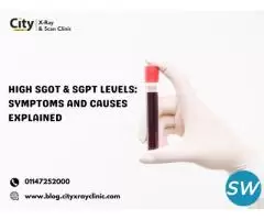 High SGOT & SGPT Levels