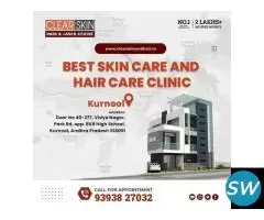 best Vitiligo Treatments in india