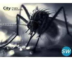 Malaria Symptoms and Blood Test Name - 1