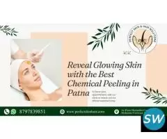 Best Chemical Peel Treatment in Patna