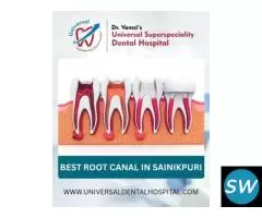 Top Reasons to Choose a Root Canal Specialist