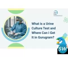 What Is a Urine Culture Test, - 1
