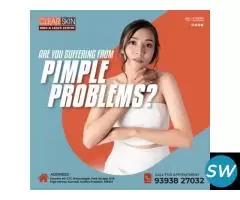 Best Birthmark removal laser treatment