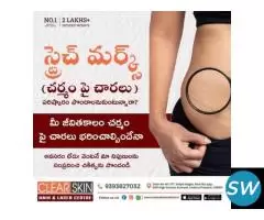 Best Advanced Acne Laser Treatment in India