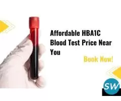 HbA1c Blood Test: Purpose, Normal Range