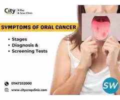 Symptoms of Oral Cancer