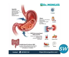 Best gastroenterologists in Delhi - 1