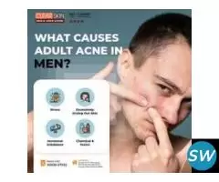 Advance Tattoo Removal Treatment  in india