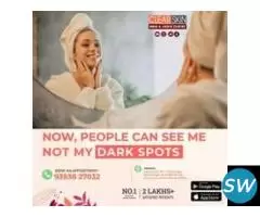 portwine stain treatment in india